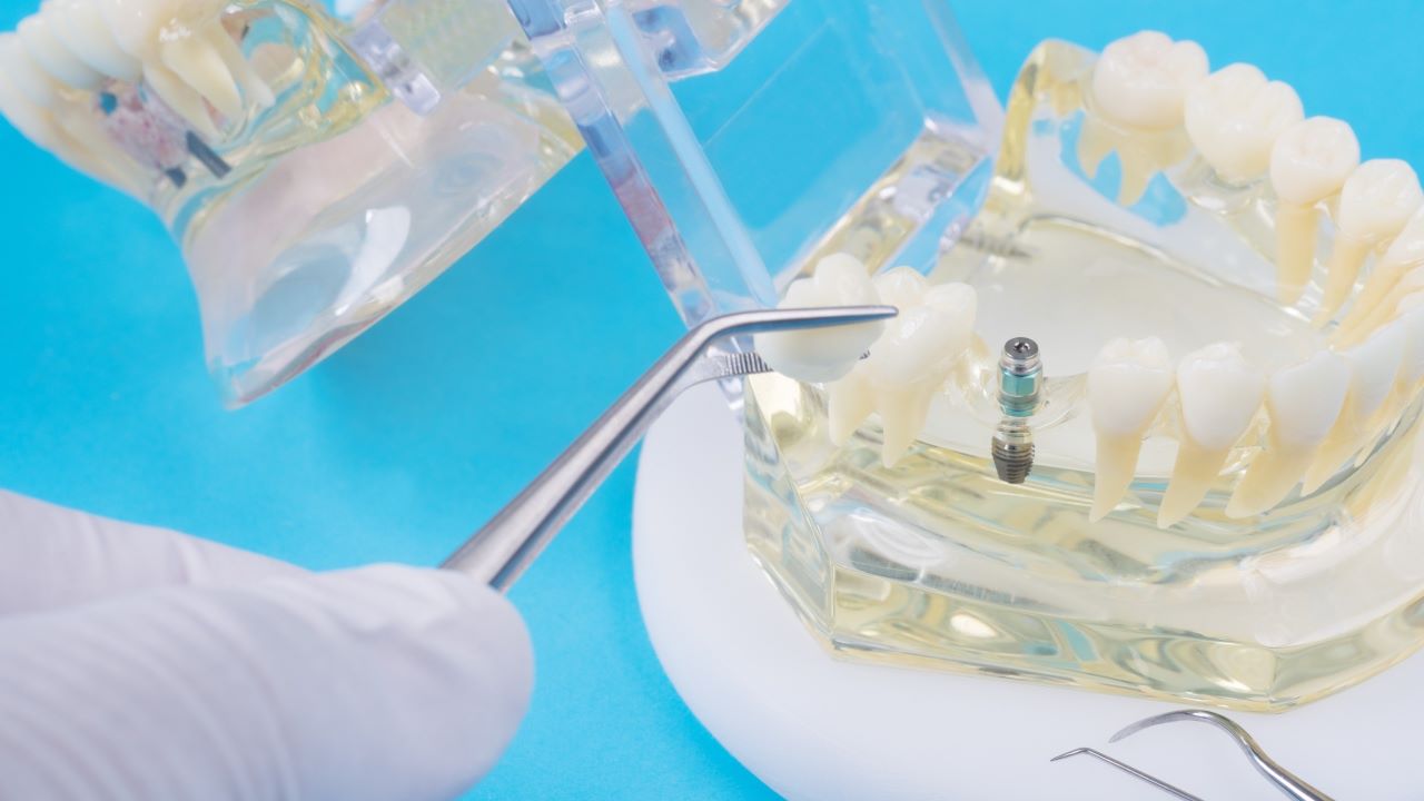 Praca nad protezą: Technik dentystyczny
