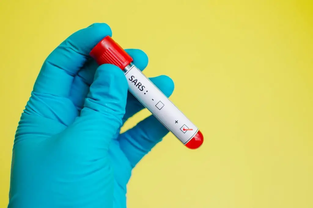 Test na covid za 30 zł - próbówka w dłoni z rękawiczką