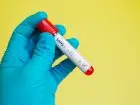 Test na covid za 30 zł - próbówka w dłoni z rękawiczką