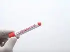 Fiolka z napsiem coronavirus trzymana w dłoni w rękawiczce